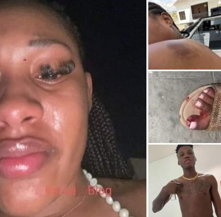 SHAMEFUL: 17 Year-Old Yahoo Boy Reportedly Beats 28 Year-Old Girlfriend to Pulp